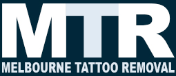 MELBOURNE TATTOO REMOVAL
