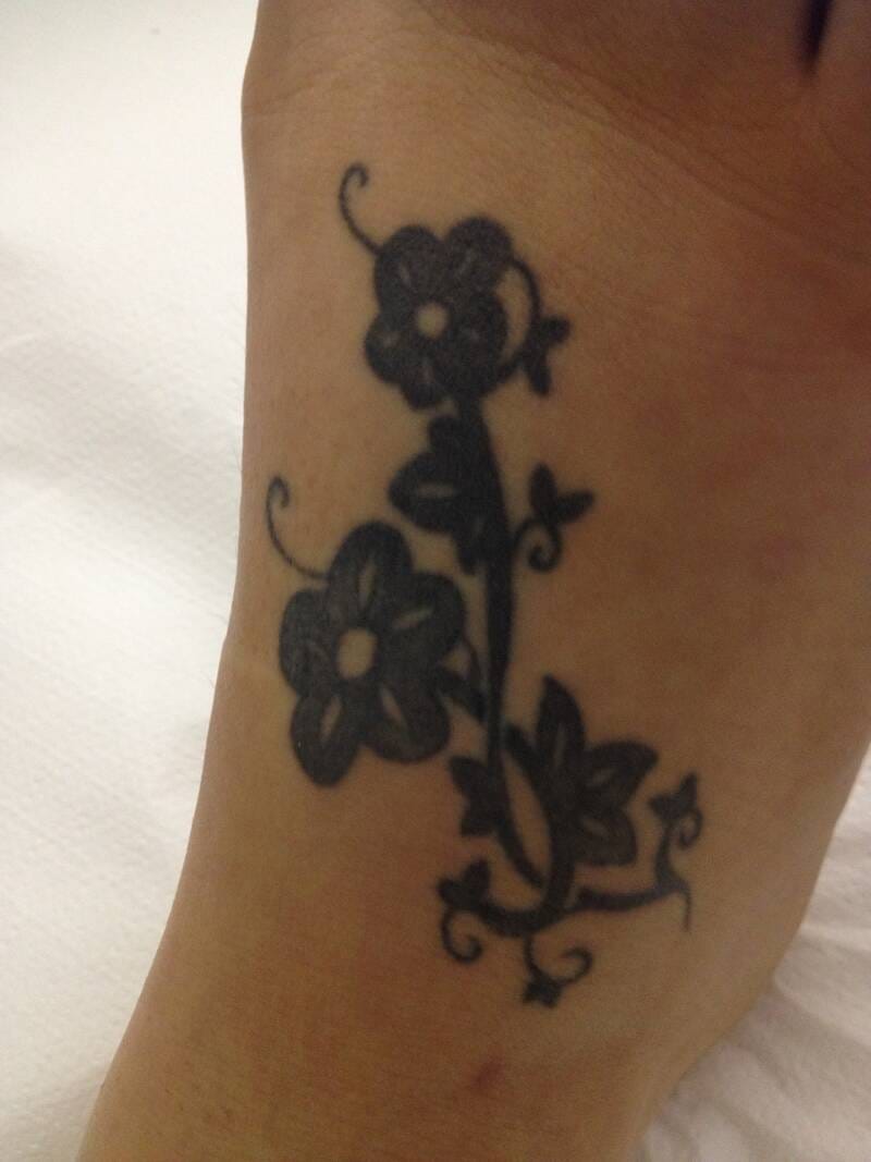 tattoo-removal-before--after-no.-25-pic-12 tattoo-removal-before--after-no.-25-pic-12