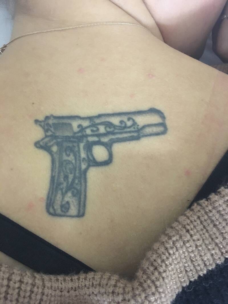 tattoo-removal-before--after-no.-26-pic-12 tattoo-removal-before--after-no.-26-pic-12